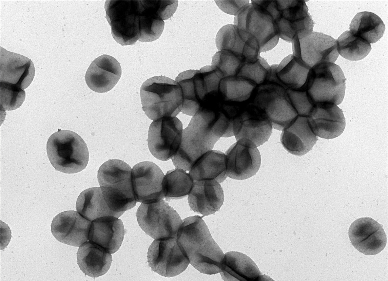 폐수에서 신경계 독성물질을 분해하는 박테리아 파라코커스 코뮤니스 전자 현미경으로 확대한 모습 [사진=국립생물자원관]